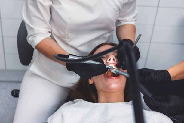 Best Dentist for Tooth Abscess  in Union City, CA
